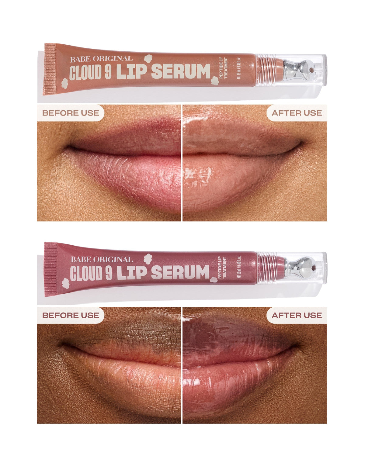 Before and after lip results with Cloud 9 Lip Serum
